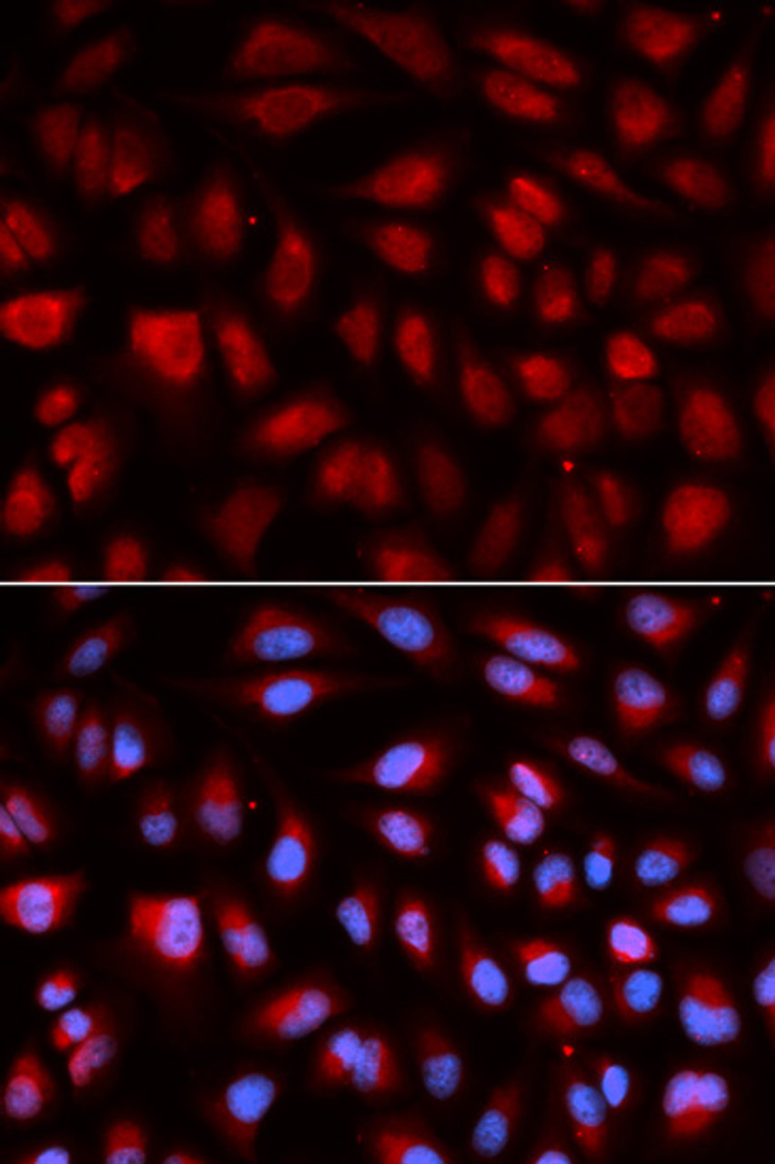 Immunofluorescence analysis of U2OS cells using PLK1 antibody (18-702) . Blue: DAPI for nuclear staining.