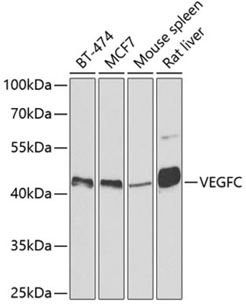 Western blot analysis of extracts of various cell lines, using VEGFC antibody (18-707) at 1:500 dilution.<br/>Secondary antibody: HRP Goat Anti-Rabbit IgG (H+L) at 1:10000 dilution.<br/>Lysates/proteins: 25ug per lane.<br/>Blocking buffer: 3% nonfat dry milk in TBST.<br/>Detection: ECL Basic Kit.<br/>Exposure time: 90s.