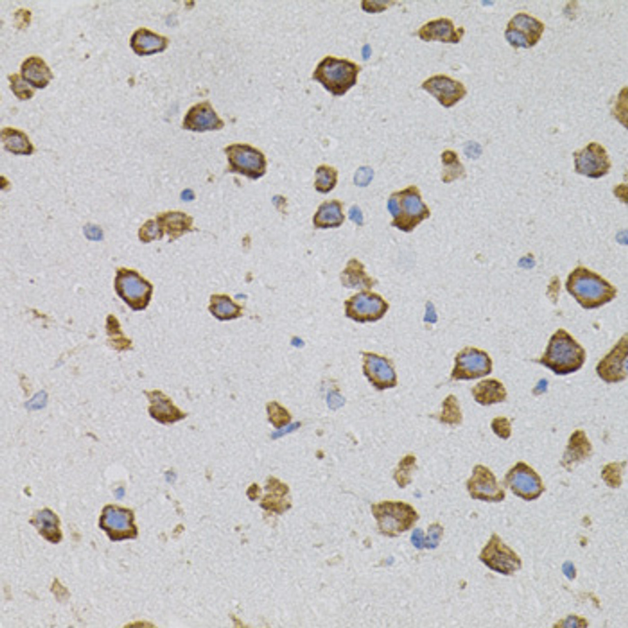 Immunohistochemistry of paraffin-embedded mouse brain using VEGFC antibody (18-707) (40x lens) .