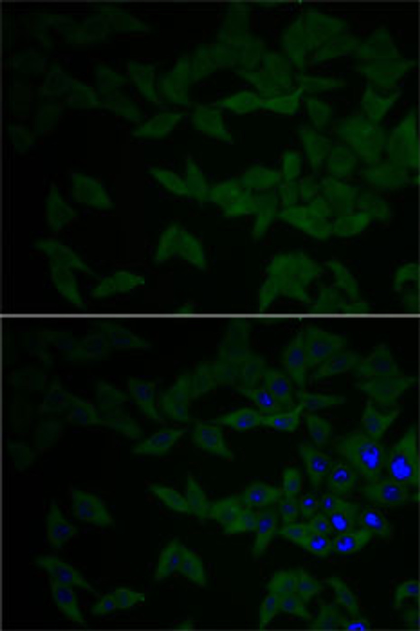 Immunofluorescence analysis of HeLa cells using GNB2L1 antibody (18-711) . Blue: DAPI for nuclear staining.
