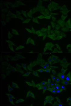 Immunofluorescence analysis of HeLa cells using GNB2L1 antibody (18-711) . Blue: DAPI for nuclear staining.