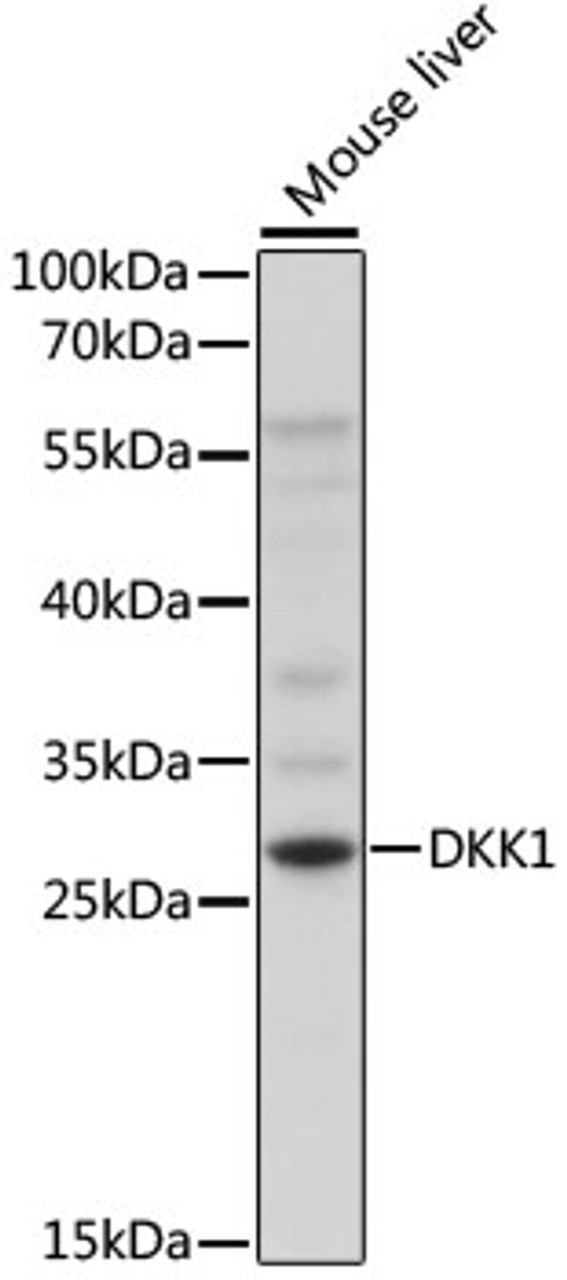 Western blot analysis of extracts of mouse liver, using DKK1 antibody (18-713) at 1:1000 dilution.<br/>Secondary antibody: HRP Goat Anti-Rabbit IgG (H+L) at 1:10000 dilution.<br/>Lysates/proteins: 25ug per lane.<br/>Blocking buffer: 3% nonfat dry milk in TBST.<br/>Detection: ECL Enhanced Kit.<br/>Exposure time: 5s.