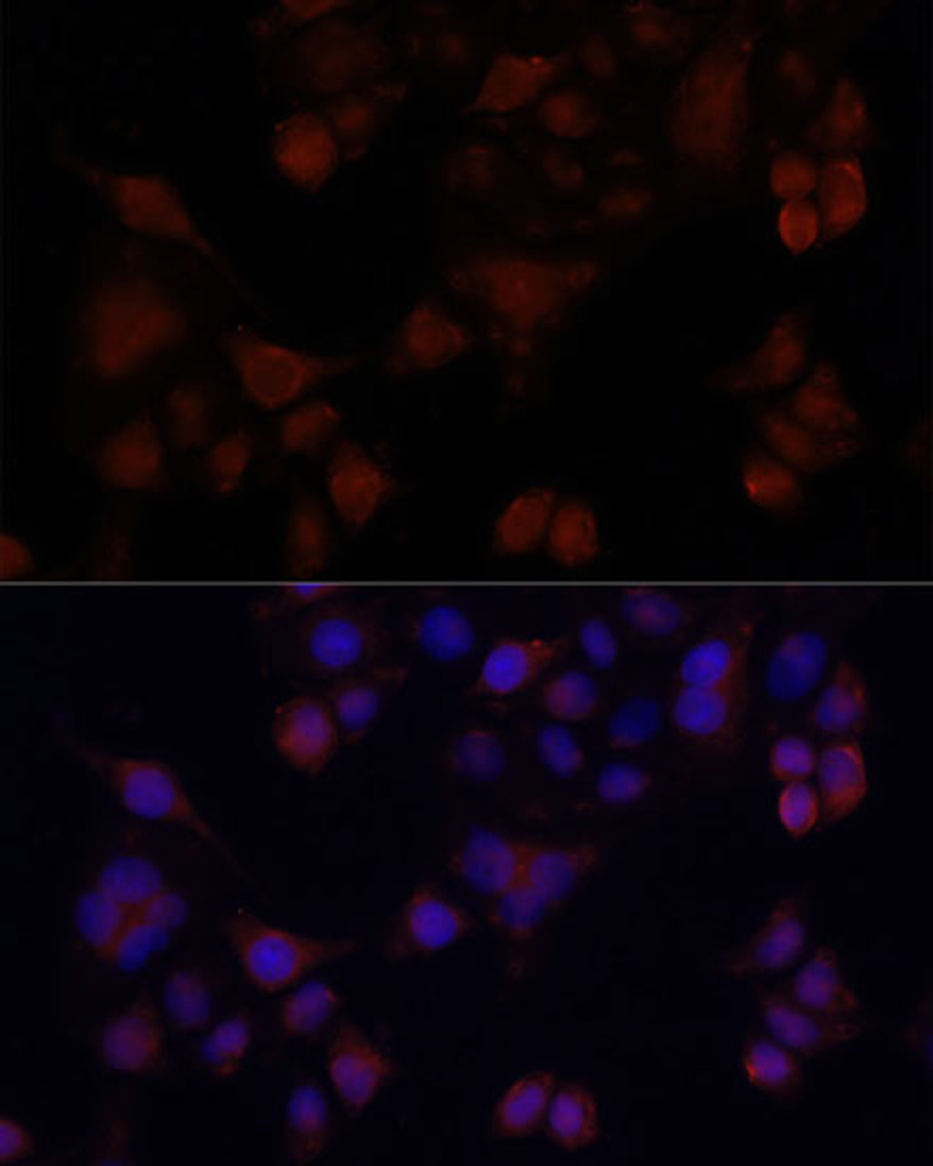 Immunofluorescence analysis of HeLa cells using MAPRE1 antibody (18-737) at dilution of 1:100. Blue: DAPI for nuclear staining.