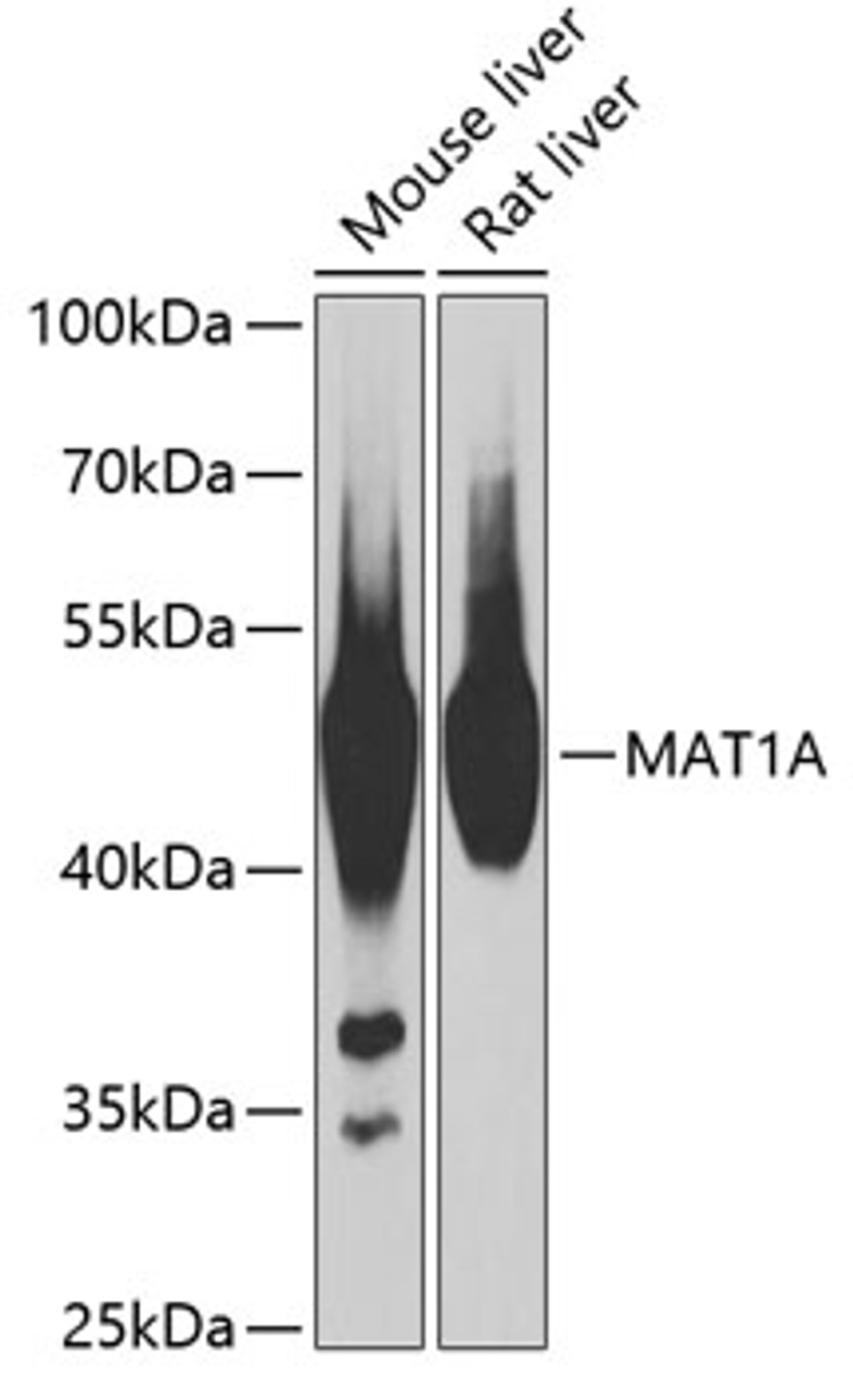 Western blot analysis of extracts of various cell lines, using MAT1A antibody (18-744) at 1:1000 dilution.<br/>Secondary antibody: HRP Goat Anti-Rabbit IgG (H+L) at 1:10000 dilution.<br/>Lysates/proteins: 25ug per lane.<br/>Blocking buffer: 3% nonfat dry milk in TBST.<br/>Detection: ECL Basic Kit.<br/>Exposure time: 3s.