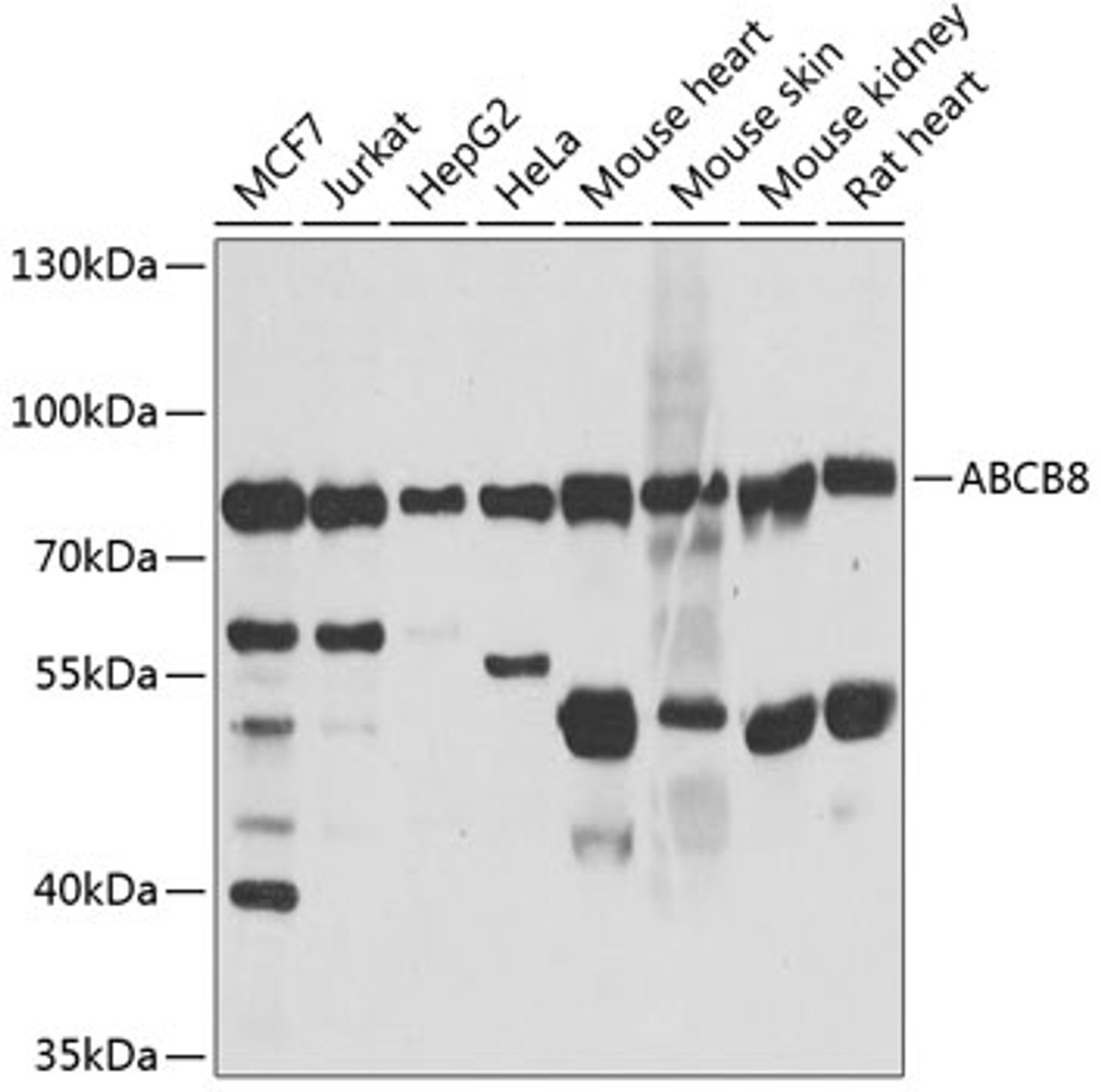 Western blot analysis of extracts of various cell lines, using ABCB8 antibody (18-750) at 1:1000 dilution.<br/>Secondary antibody: HRP Goat Anti-Rabbit IgG (H+L) at 1:10000 dilution.<br/>Lysates/proteins: 25ug per lane.<br/>Blocking buffer: 3% nonfat dry milk in TBST.<br/>Detection: ECL Basic Kit.<br/>Exposure time: 5s.