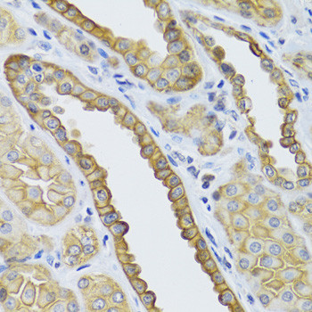 Immunohistochemistry of paraffin-embedded human kidney using KRT5 Antibody (18-754) at dilution of 1:100 (40x lens) .
