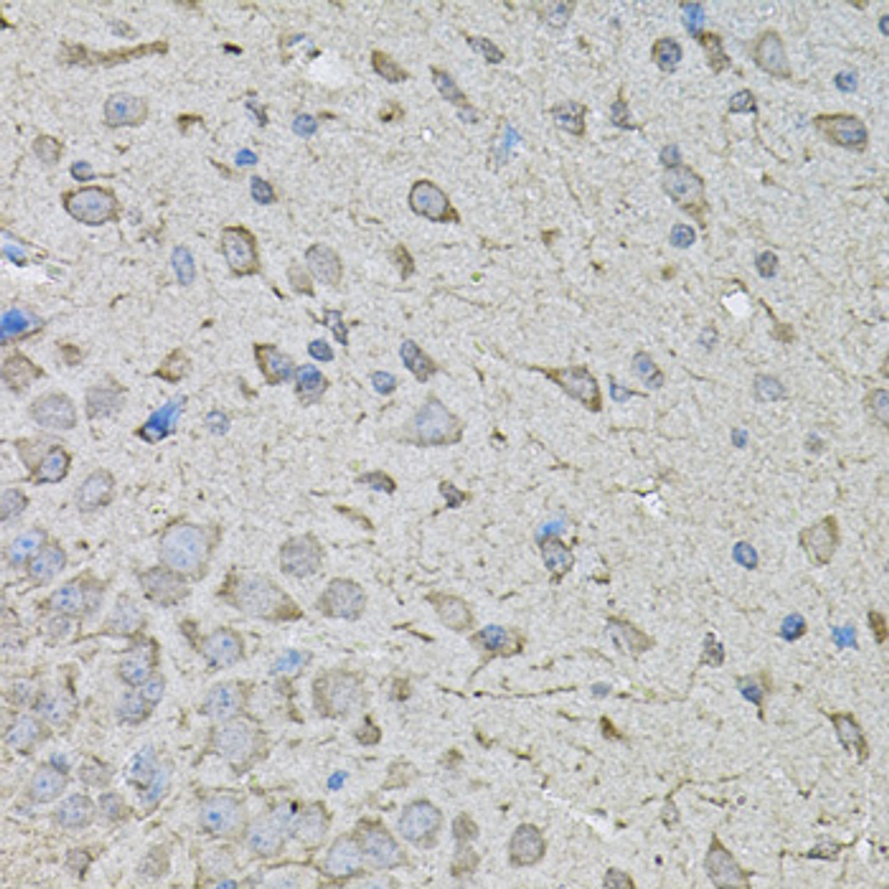Immunohistochemistry of paraffin-embedded mouse brain using CDK10 antibody (18-768) at dilution of 1:100 (40x lens) .