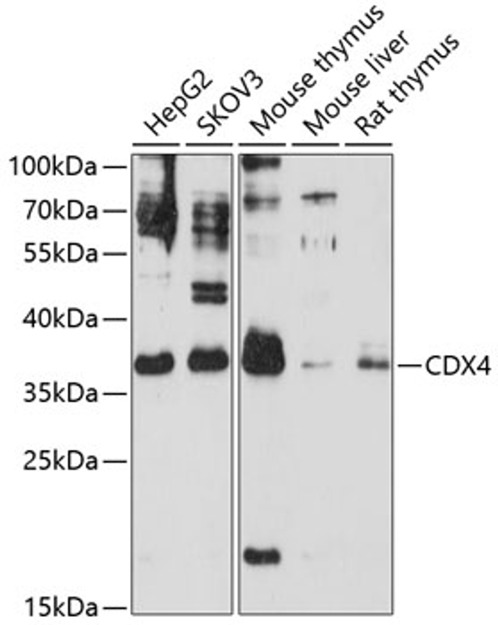 Western blot analysis of extracts of various cell lines, using CDX4 antibody (18-776) at 1:3000 dilution.<br/>Secondary antibody: HRP Goat Anti-Rabbit IgG (H+L) at 1:10000 dilution.<br/>Lysates/proteins: 25ug per lane.<br/>Blocking buffer: 3% nonfat dry milk in TBST.<br/>Detection: ECL Basic Kit.<br/>Exposure time: 60s.