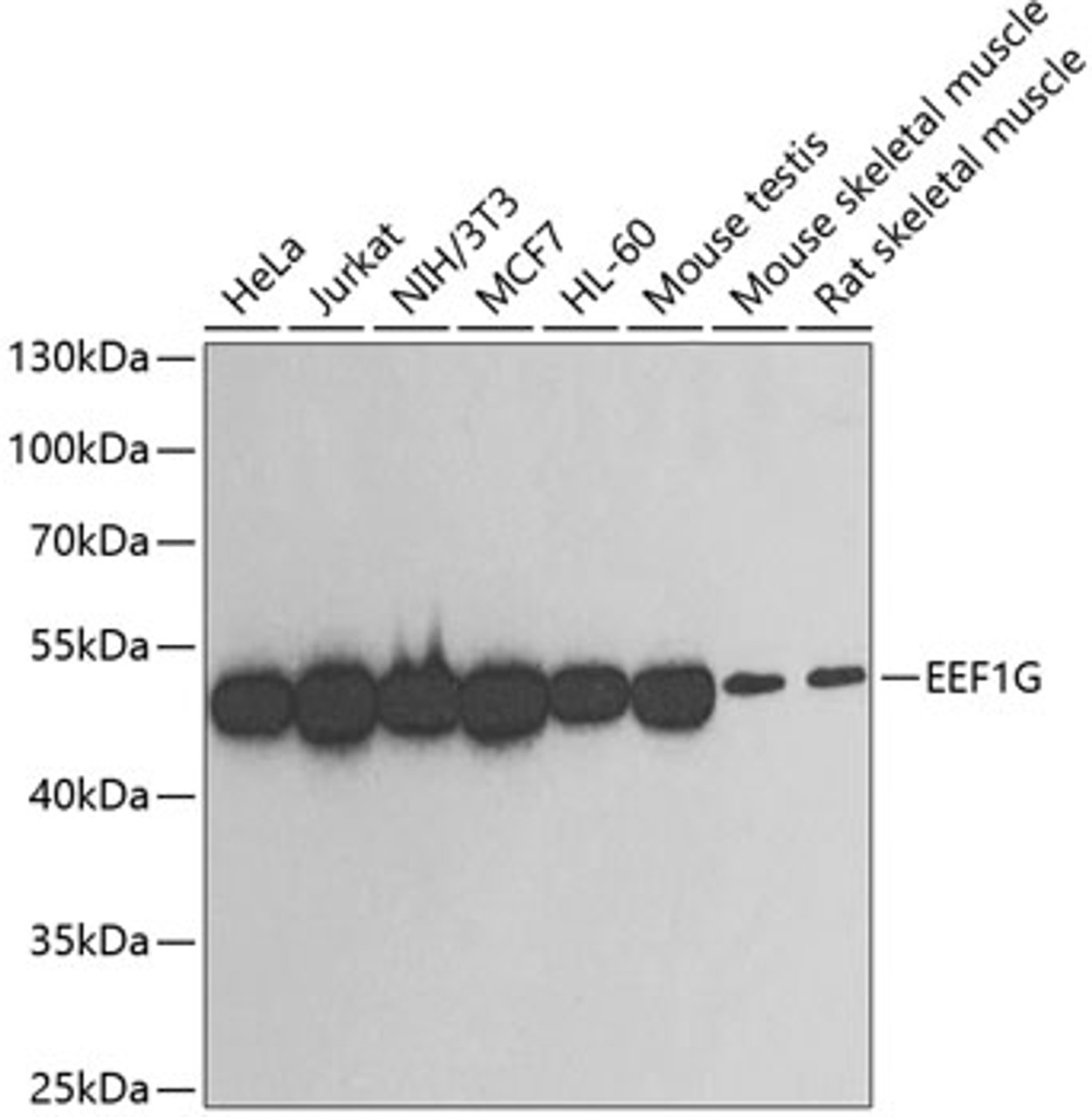 Western blot analysis of extracts of various cell lines, using EEF1G antibody (18-785) at 1:500 dilution.<br/>Secondary antibody: HRP Goat Anti-Rabbit IgG (H+L) at 1:10000 dilution.<br/>Lysates/proteins: 25ug per lane.<br/>Blocking buffer: 3% nonfat dry milk in TBST.<br/>Detection: ECL Enhanced Kit.<br/>Exposure time: 30s.