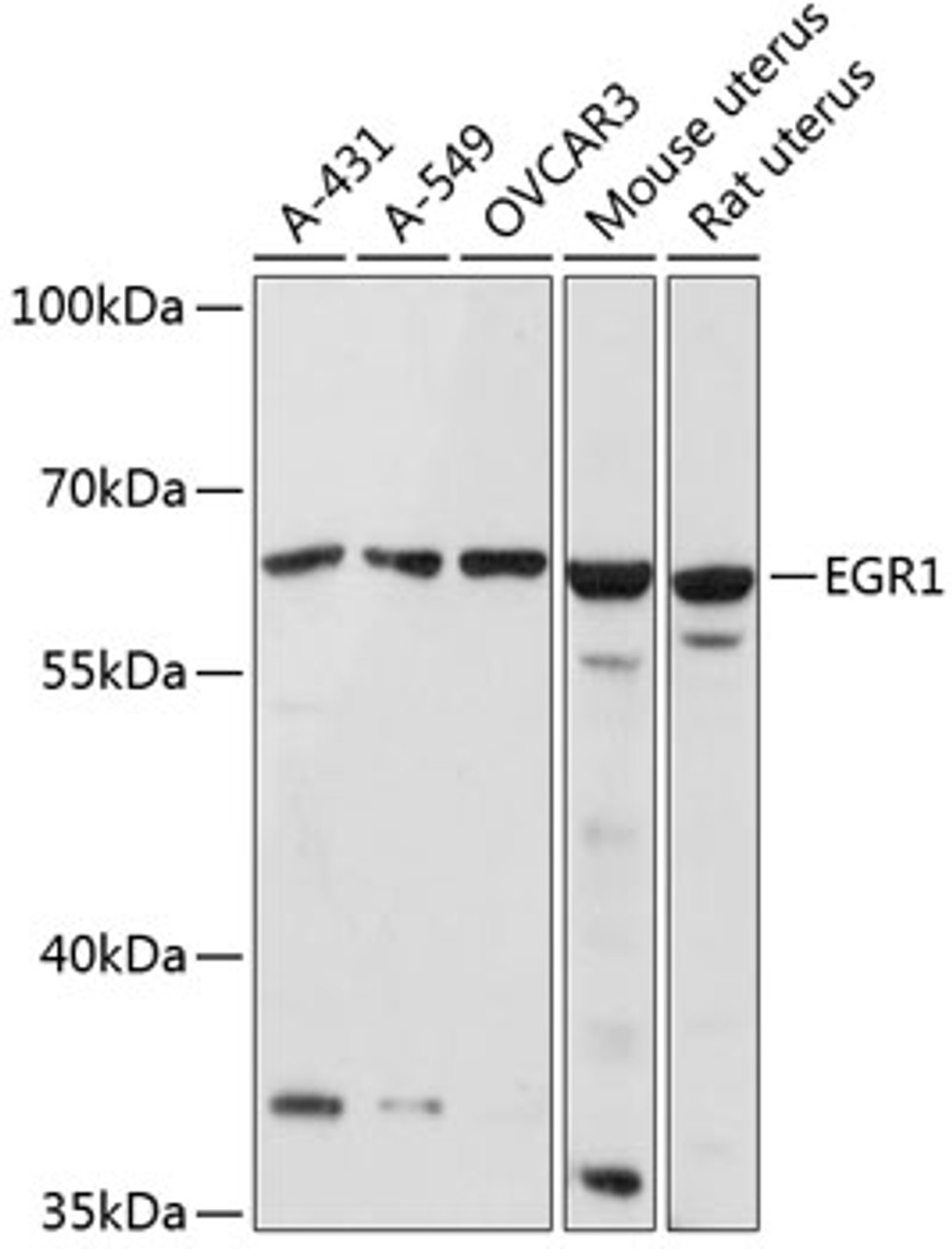 Western blot analysis of extracts of various cell lines, using EGR1 antibody (18-786) at 1:1000 dilution.<br/>Secondary antibody: HRP Goat Anti-Rabbit IgG (H+L) at 1:10000 dilution.<br/>Lysates/proteins: 25ug per lane.<br/>Blocking buffer: 3% nonfat dry milk in TBST.<br/>Detection: ECL Basic Kit.<br/>Exposure time: 60s.