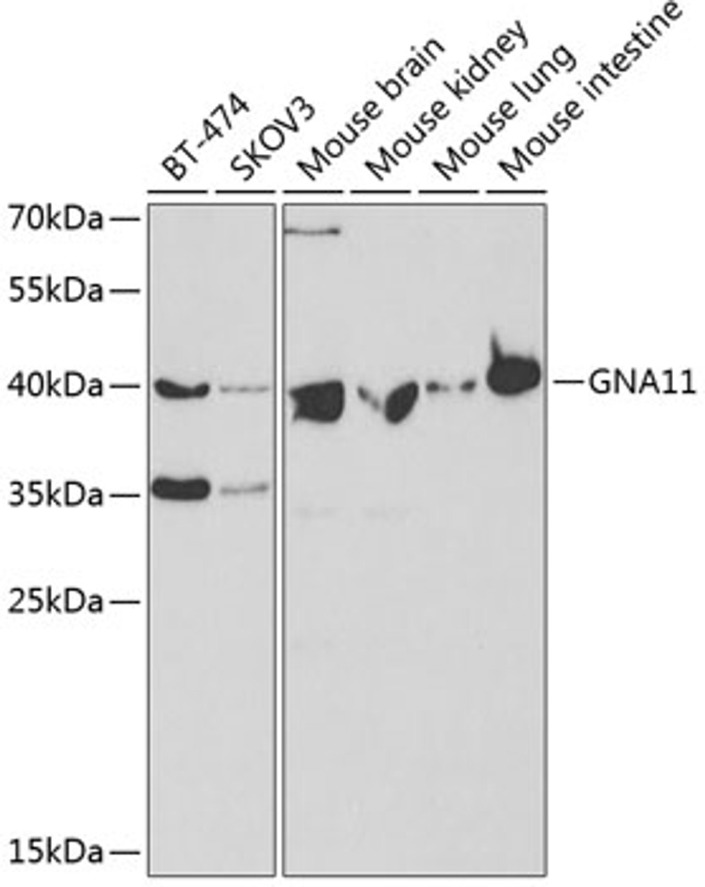 Western blot analysis of extracts of various cell lines, using GNA11 antibody (18-792) at 1:400 dilution.<br/>Secondary antibody: HRP Goat Anti-Rabbit IgG (H+L) at 1:10000 dilution.<br/>Lysates/proteins: 25ug per lane.<br/>Blocking buffer: 3% nonfat dry milk in TBST.<br/>Detection: ECL Basic Kit.<br/>Exposure time: 90s.