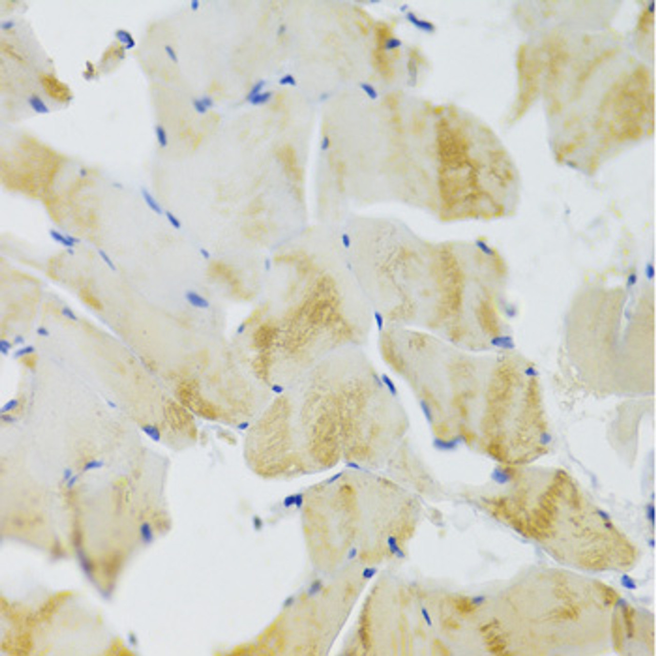 Immunohistochemistry of paraffin-embedded rat skeletal muscle using TRAP1 Antibody (18-800) at dilution of 1:100 (40x lens) .