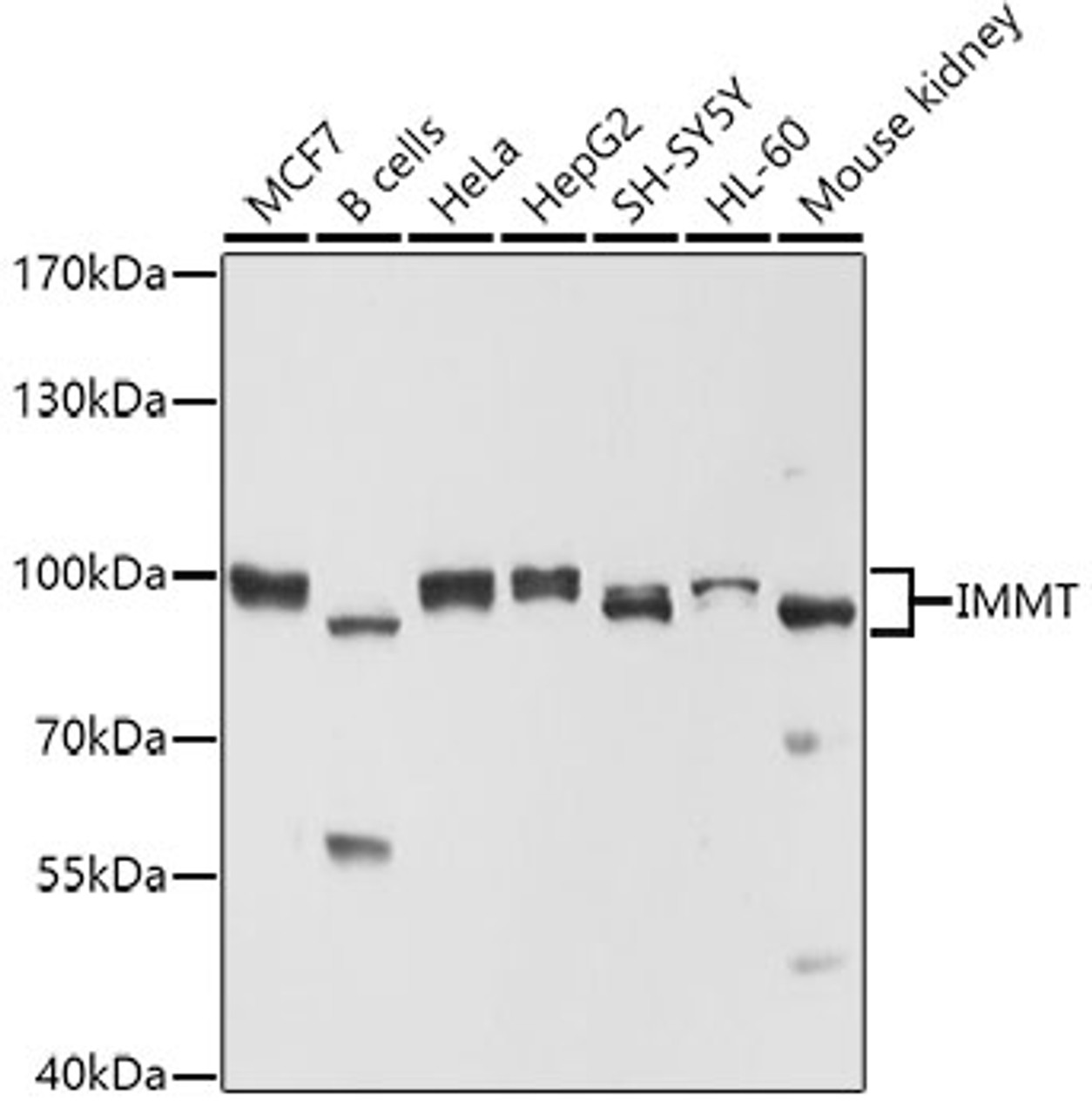 Western blot analysis of extracts of various cell lines, using IMMT antibody (18-803) at 1:1000 dilution.<br/>Secondary antibody: HRP Goat Anti-Rabbit IgG (H+L) at 1:10000 dilution.<br/>Lysates/proteins: 25ug per lane.<br/>Blocking buffer: 3% nonfat dry milk in TBST.<br/>Detection: ECL Basic Kit.<br/>Exposure time: 30s.