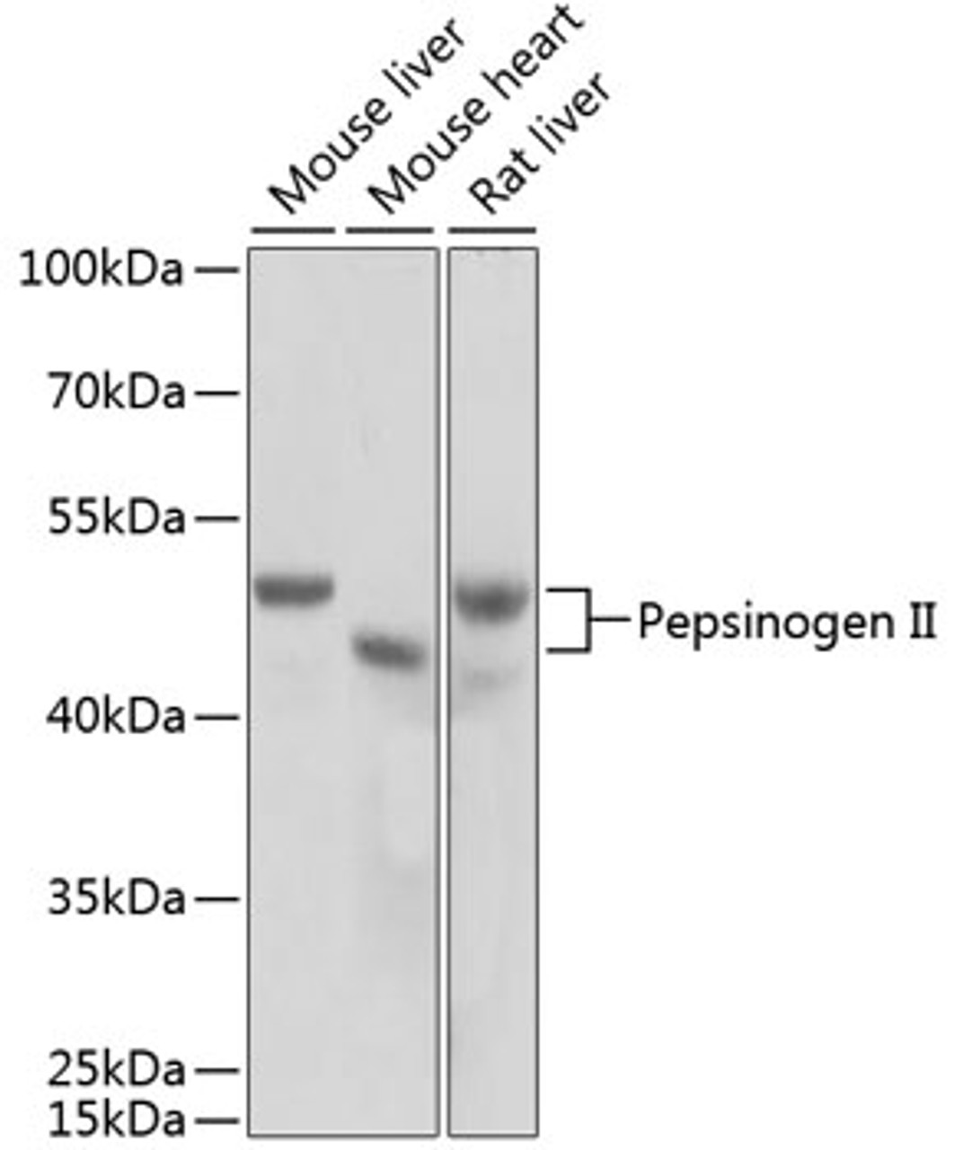 Western blot analysis of extracts of various cell lines, using Pepsinogen II antibody (18-813) at 1:1000 dilution.<br/>Secondary antibody: HRP Goat Anti-Rabbit IgG (H+L) at 1:10000 dilution.<br/>Lysates/proteins: 25ug per lane.<br/>Blocking buffer: 3% nonfat dry milk in TBST.<br/>Detection: ECL Basic Kit.<br/>Exposure time: 5s.