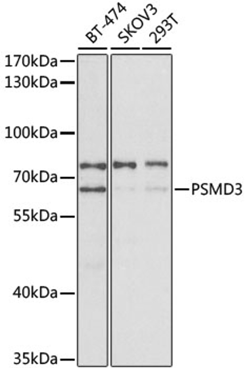 Western blot analysis of extracts of various cell lines, using PSMD3 antibody (18-814) at 1:400 dilution.<br/>Secondary antibody: HRP Goat Anti-Rabbit IgG (H+L) at 1:10000 dilution.<br/>Lysates/proteins: 25ug per lane.<br/>Blocking buffer: 3% nonfat dry milk in TBST.<br/>Detection: ECL Basic Kit.<br/>Exposure time: 90s.