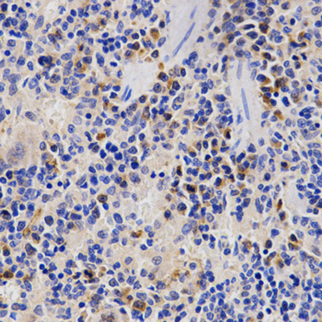 Immunohistochemistry of paraffin-embedded rat spleen using PSMD3 antibody (18-814) at dilution of 1:200 (40x lens) .
