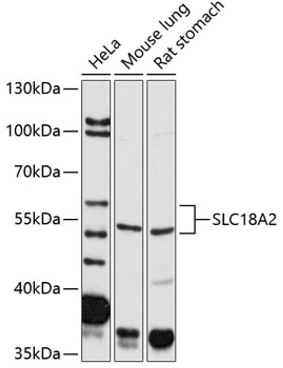 Western blot analysis of extracts of various cell lines, using SLC18A2 antibody (18-818) at 1:2000 dilution.<br/>Secondary antibody: HRP Goat Anti-Rabbit IgG (H+L) at 1:10000 dilution.<br/>Lysates/proteins: 25ug per lane.<br/>Blocking buffer: 3% nonfat dry milk in TBST.<br/>Detection: ECL Basic Kit.<br/>Exposure time: 30s.