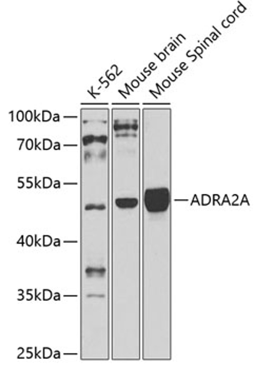 Western blot analysis of extracts of various cell lines, using ADRA2A antibody (18-821) at 1:1000 dilution.<br/>Secondary antibody: HRP Goat Anti-Rabbit IgG (H+L) at 1:10000 dilution.<br/>Lysates/proteins: 25ug per lane.<br/>Blocking buffer: 3% nonfat dry milk in TBST.<br/>Detection: ECL Basic Kit.<br/>Exposure time: 30s.