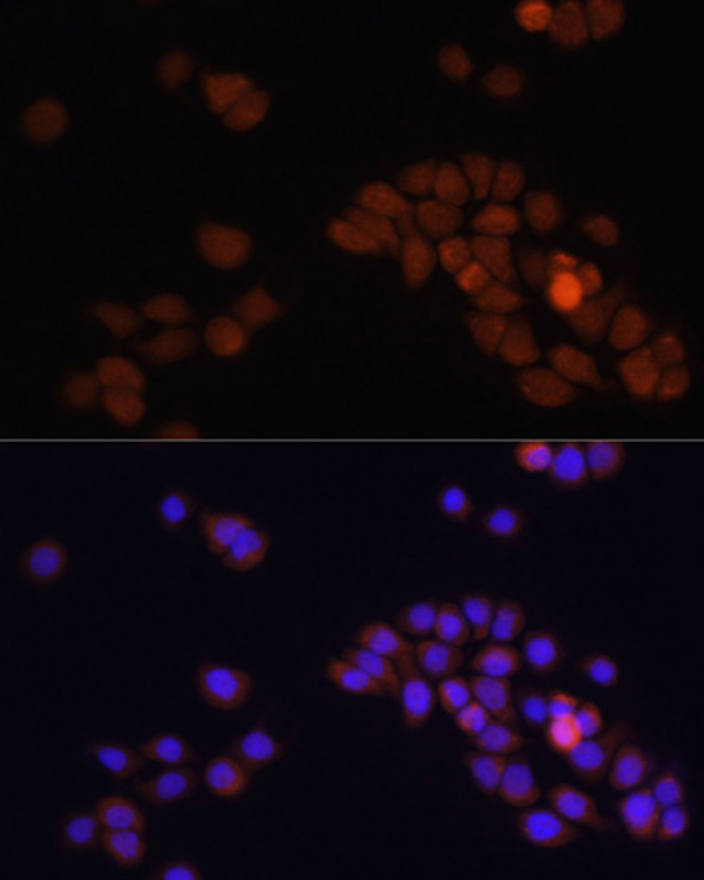 Immunofluorescence analysis of HT-29 cells using APC antibody (18-827) at dilution of 1:100. Blue: DAPI for nuclear staining.