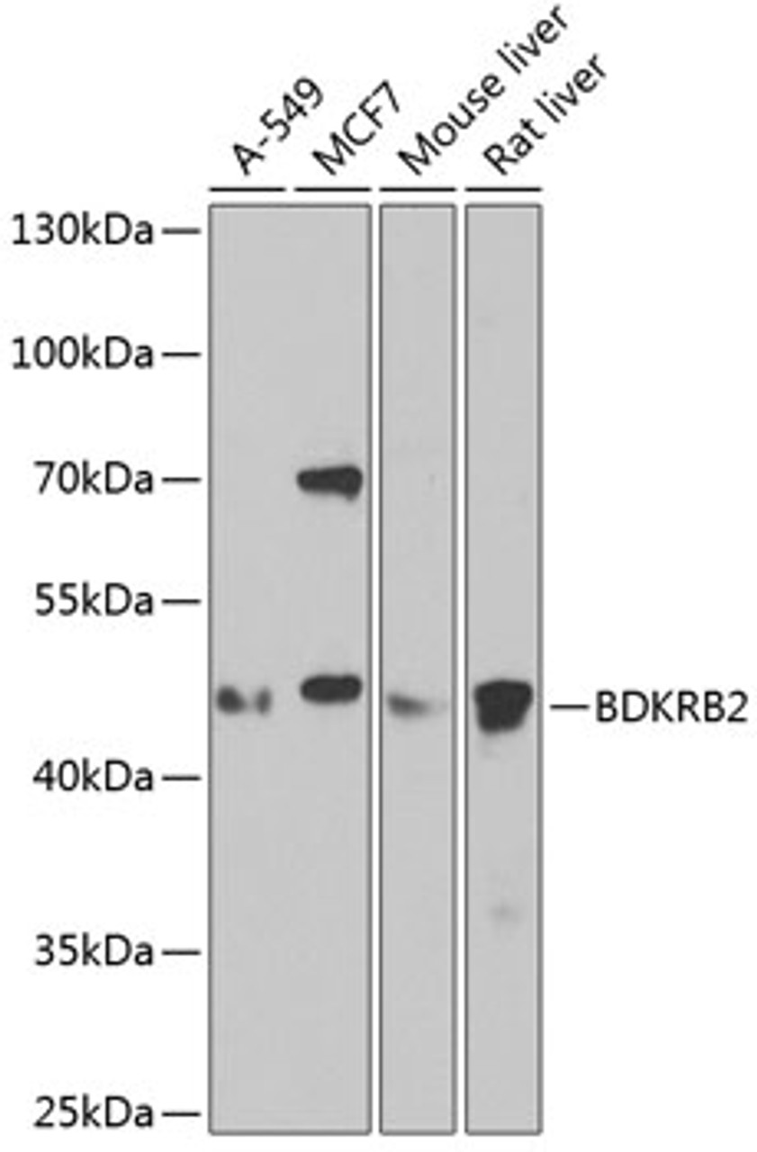 Western blot analysis of extracts of various cell lines, using BDKRB2 antibody (18-833) at 1:1000 dilution.<br/>Secondary antibody: HRP Goat Anti-Rabbit IgG (H+L) at 1:10000 dilution.<br/>Lysates/proteins: 25ug per lane.<br/>Blocking buffer: 3% nonfat dry milk in TBST.<br/>Detection: ECL Enhanced Kit.<br/>Exposure time: 90s.