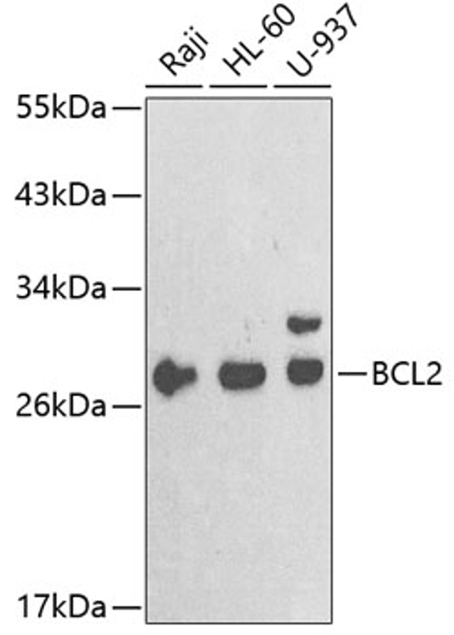 Western blot analysis of extracts of various cell lines, using BCL2 antibody (18-834) at 1:1000 dilution.<br/>Secondary antibody: HRP Goat Anti-Rabbit IgG (H+L) at 1:10000 dilution.<br/>Lysates/proteins: 25ug per lane.<br/>Blocking buffer: 3% nonfat dry milk in TBST.