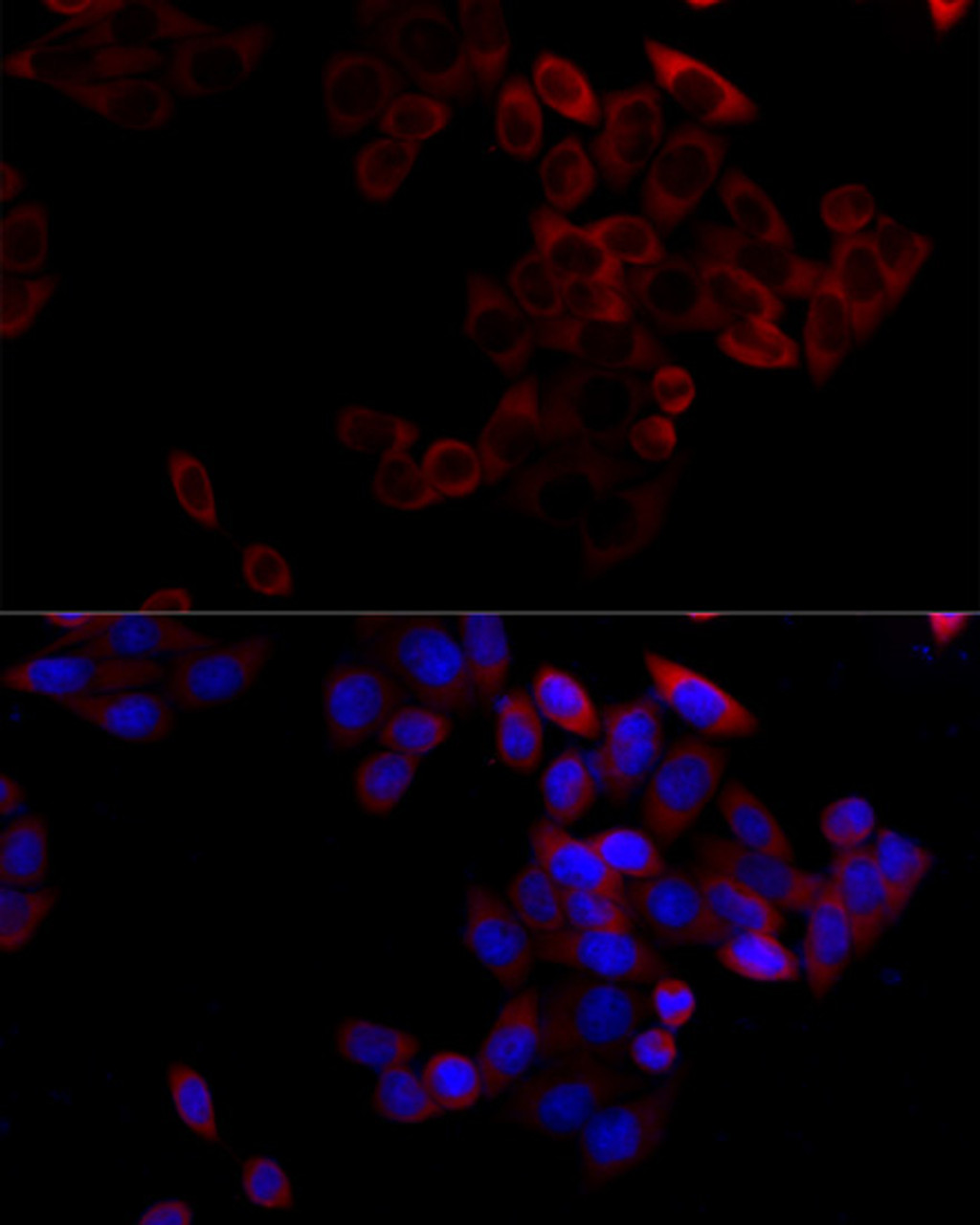 Immunofluorescence analysis of HeLa cells using Bcl2 antibody (18-834) at dilution of 1:100 (40x lens) . Blue: DAPI for nuclear staining.