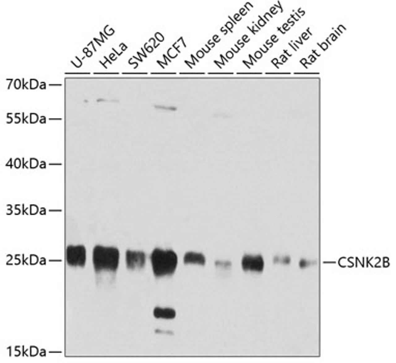 Western blot analysis of extracts of various cell lines, using CSNK2B antibody (18-840) at 1:1000 dilution.<br/>Secondary antibody: HRP Goat Anti-Rabbit IgG (H+L) at 1:10000 dilution.<br/>Lysates/proteins: 25ug per lane.<br/>Blocking buffer: 3% nonfat dry milk in TBST.<br/>Detection: ECL Basic Kit.<br/>Exposure time: 30s.