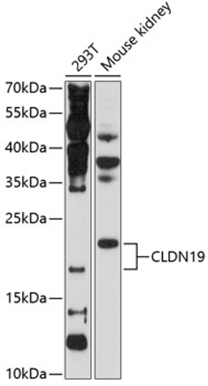 Western blot analysis of extracts of various cell lines, using CLDN19 Antibody (18-842) at 1:1000 dilution.<br/>Secondary antibody: HRP Goat Anti-Rabbit IgG (H+L) at 1:10000 dilution.<br/>Lysates/proteins: 25ug per lane.<br/>Blocking buffer: 3% nonfat dry milk in TBST.<br/>Detection: ECL Basic Kit.<br/>Exposure time: 40s.