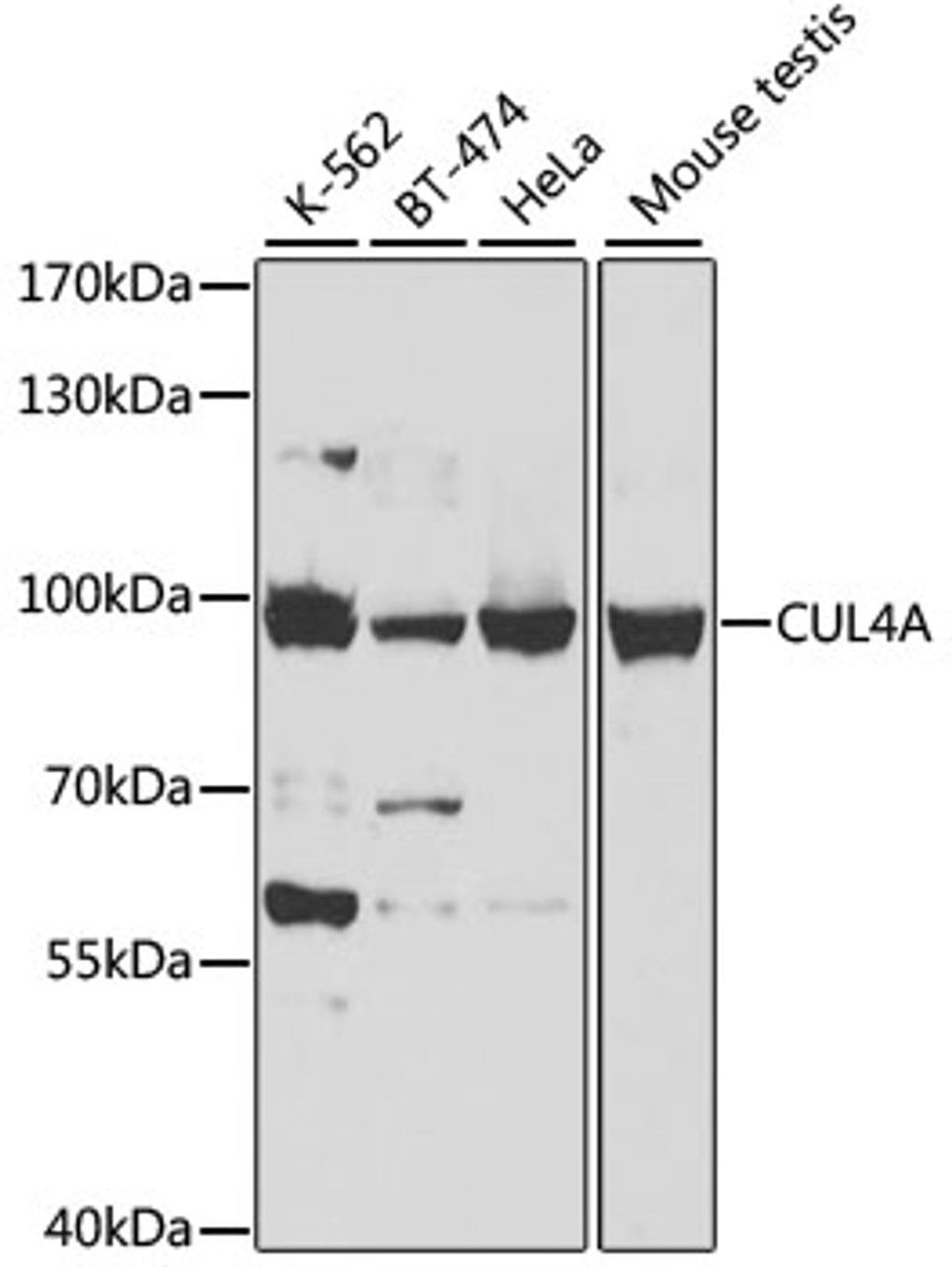 Western blot analysis of extracts of various cell lines, using CUL4A antibody (18-846) at 1:500 dilution.<br/>Secondary antibody: HRP Goat Anti-Rabbit IgG (H+L) at 1:10000 dilution.<br/>Lysates/proteins: 25ug per lane.<br/>Blocking buffer: 3% nonfat dry milk in TBST.<br/>Detection: ECL Basic Kit.<br/>Exposure time: 5s.