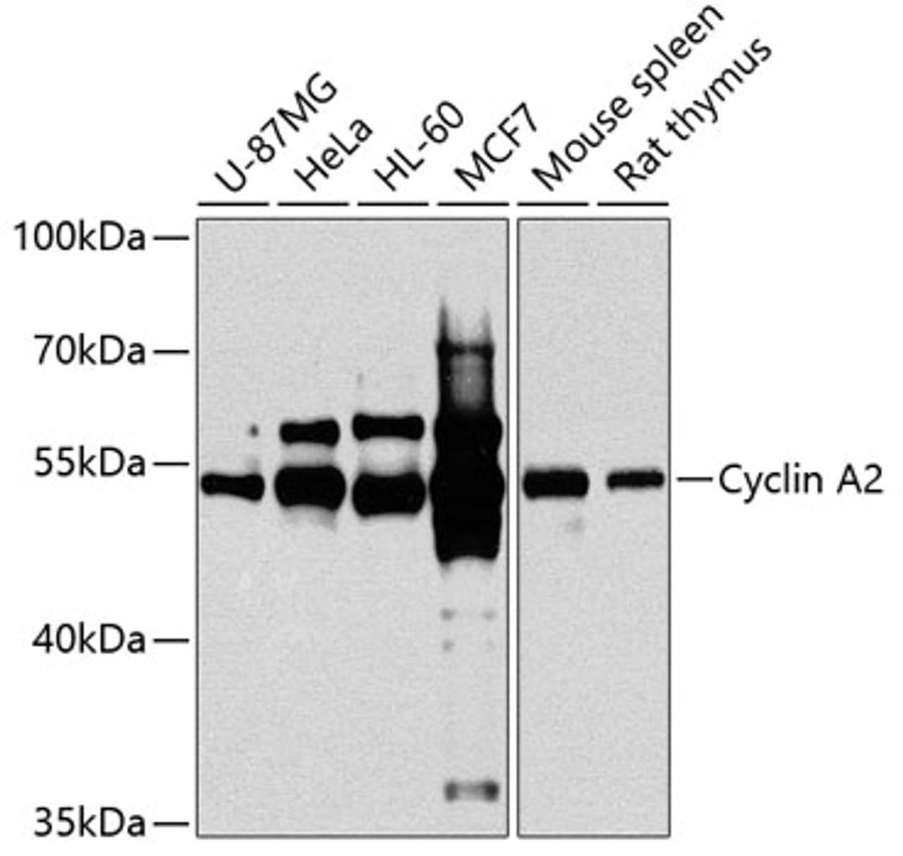 Western blot analysis of extracts of various cell lines, using Cyclin A2 antibody (18-852) at 1:1000 dilution.<br/>Secondary antibody: HRP Goat Anti-Rabbit IgG (H+L) at 1:10000 dilution.<br/>Lysates/proteins: 25ug per lane.<br/>Blocking buffer: 3% nonfat dry milk in TBST.<br/>Detection: ECL Basic Kit.<br/>Exposure time: 30s.