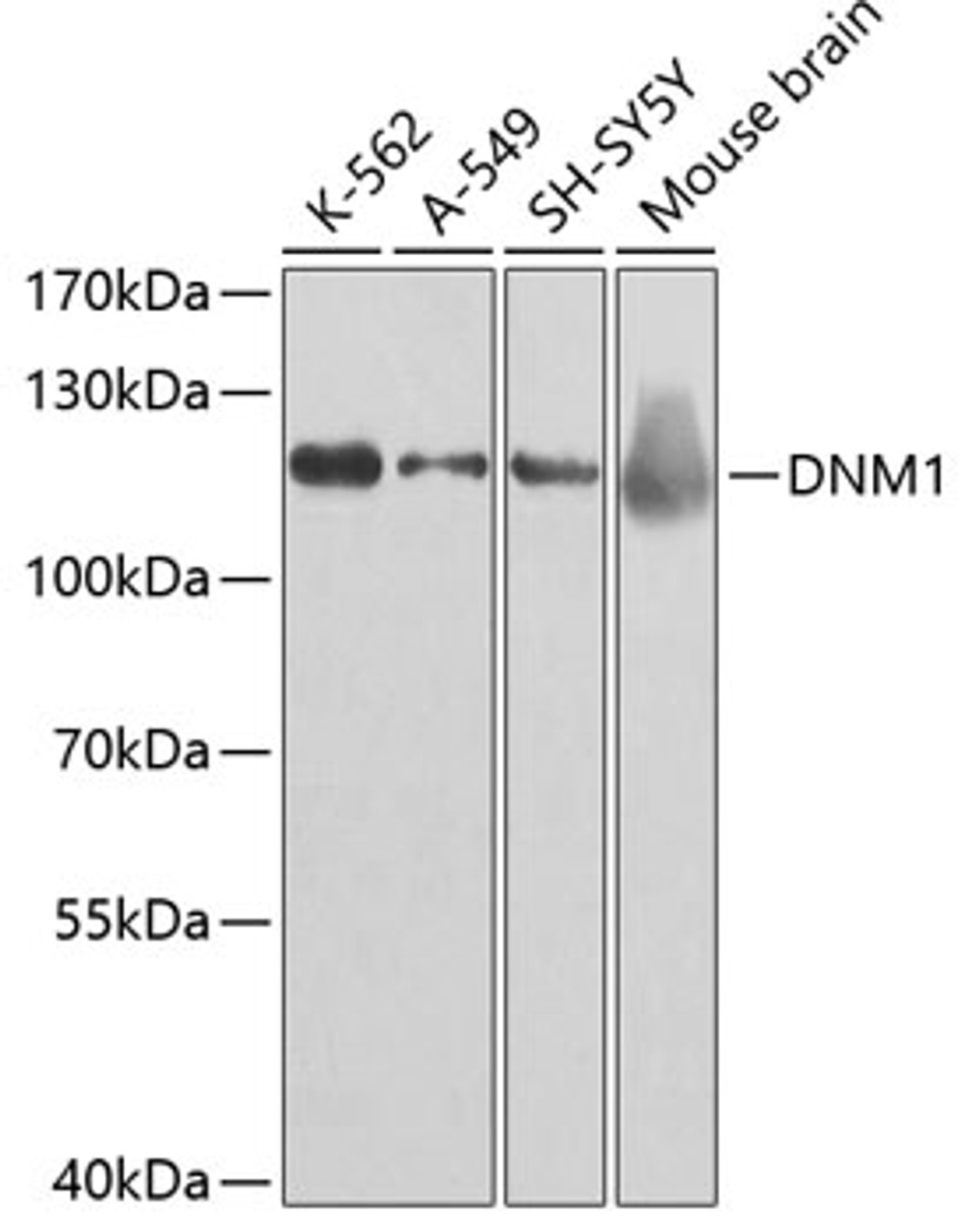 Western blot analysis of extracts of various cell lines, using DNM1 antibody (18-861) at 1:500 dilution.<br/>Secondary antibody: HRP Goat Anti-Rabbit IgG (H+L) at 1:10000 dilution.<br/>Lysates/proteins: 25ug per lane.<br/>Blocking buffer: 3% nonfat dry milk in TBST.<br/>Detection: ECL Basic Kit.<br/>Exposure time: 60s.