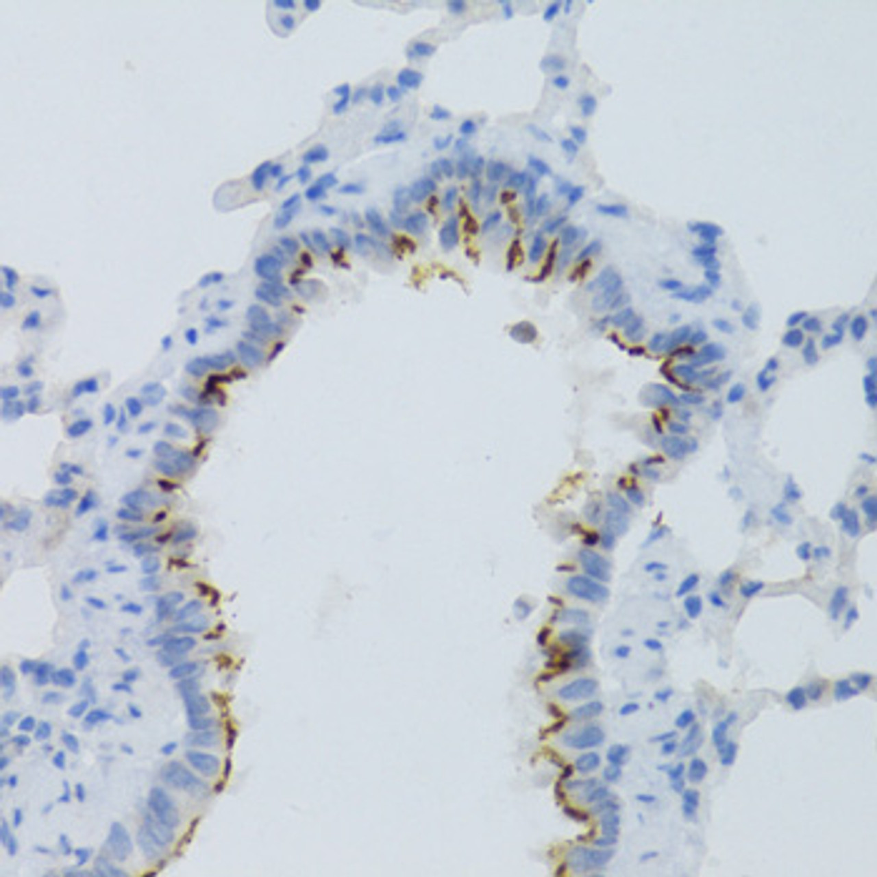 Immunohistochemistry of paraffin-embedded rat lung using PTGER2 Antibody (18-868) at dilution of 1:100 (40x lens) .