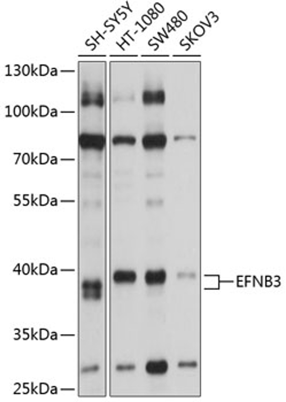 Western blot analysis of extracts of various cell lines, using EFNB3 antibody (18-869) at 1:1000 dilution.<br/>Secondary antibody: HRP Goat Anti-Rabbit IgG (H+L) at 1:10000 dilution.<br/>Lysates/proteins: 25ug per lane.<br/>Blocking buffer: 3% nonfat dry milk in TBST.<br/>Detection: ECL Basic Kit.<br/>Exposure time: 10s.