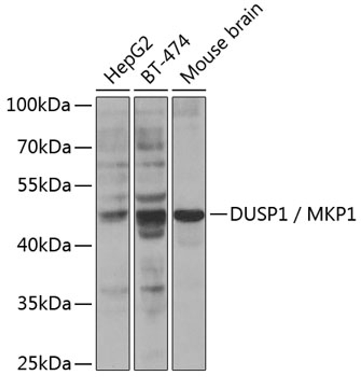 Western blot analysis of extracts of various cell lines, using DUSP1 / MKP1 Antibody (18-871) at 1:300 dilution.<br/>Secondary antibody: HRP Goat Anti-Rabbit IgG (H+L) at 1:10000 dilution.<br/>Lysates/proteins: 25ug per lane.<br/>Blocking buffer: 3% nonfat dry milk in TBST.<br/>Detection: ECL Enhanced Kit.