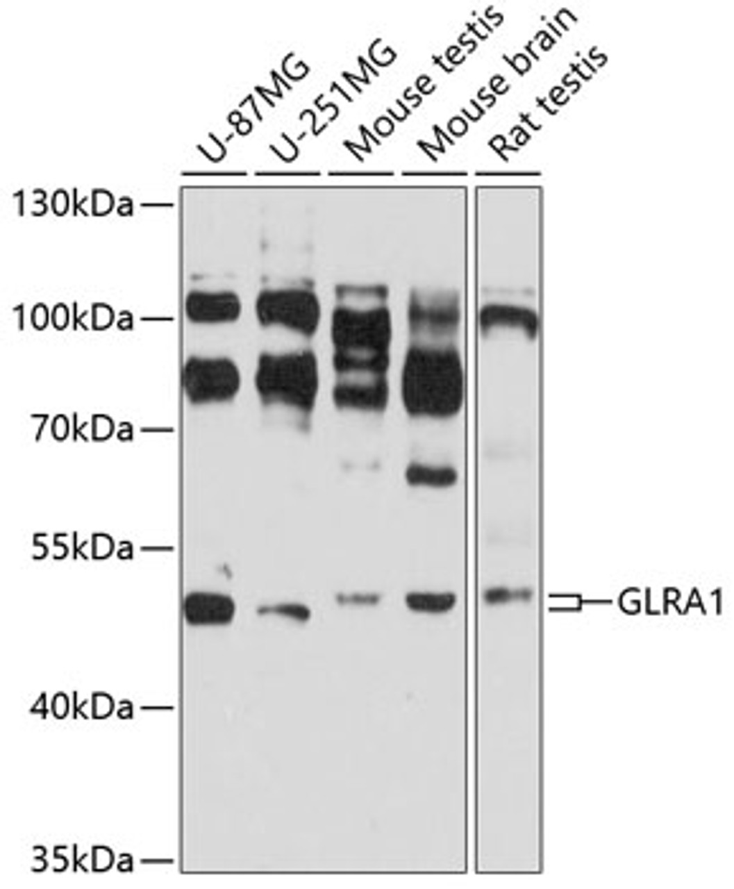 Western blot analysis of extracts of various cell lines, using GLRA1 antibody (18-882) at 1:3000 dilution.<br/>Secondary antibody: HRP Goat Anti-Rabbit IgG (H+L) at 1:10000 dilution.<br/>Lysates/proteins: 25ug per lane.<br/>Blocking buffer: 3% nonfat dry milk in TBST.<br/>Detection: ECL Basic Kit.<br/>Exposure time: 50s.