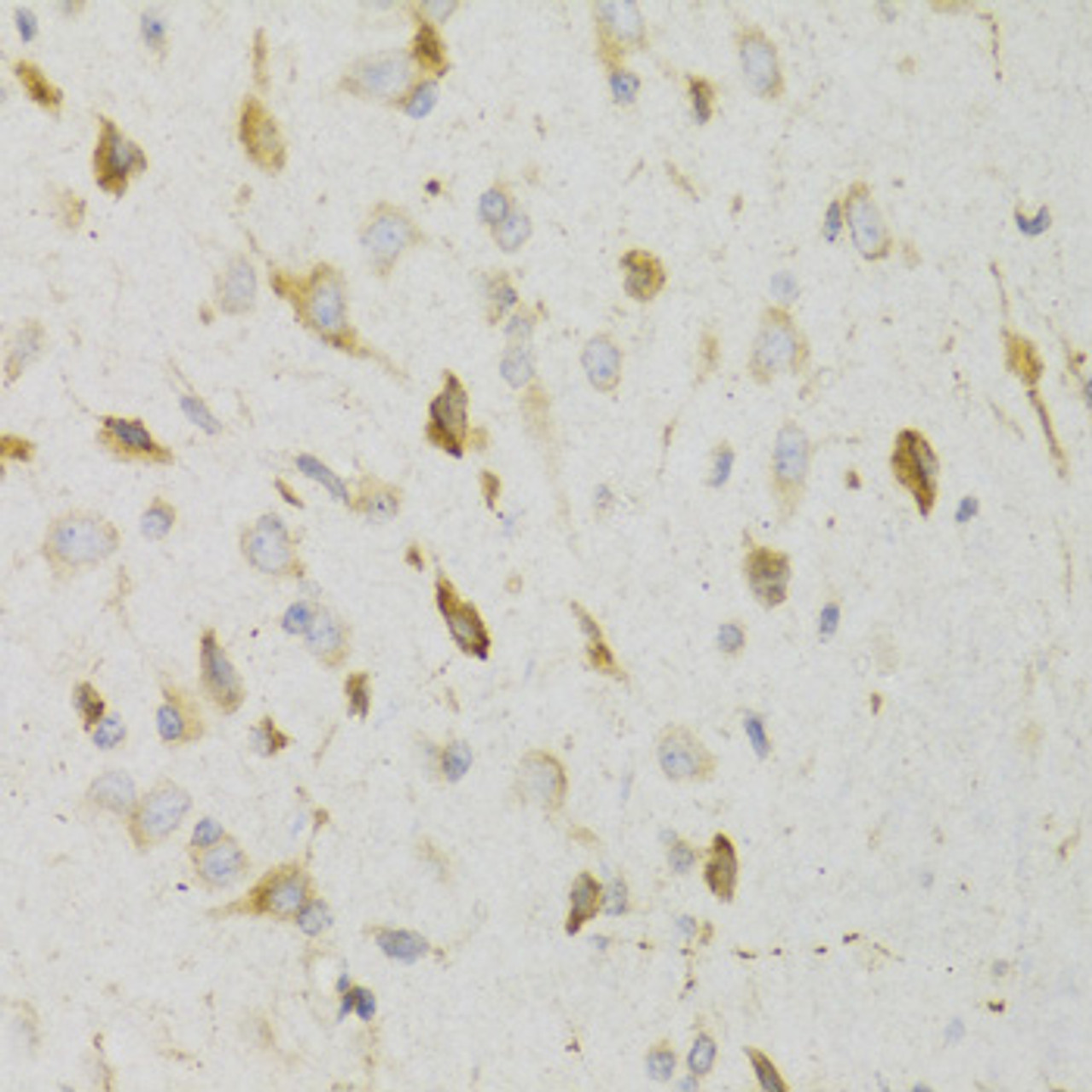Immunohistochemistry of paraffin-embedded rat brain using KISS1R Antibody (18-887) at dilution of 1:100 (40x lens) .