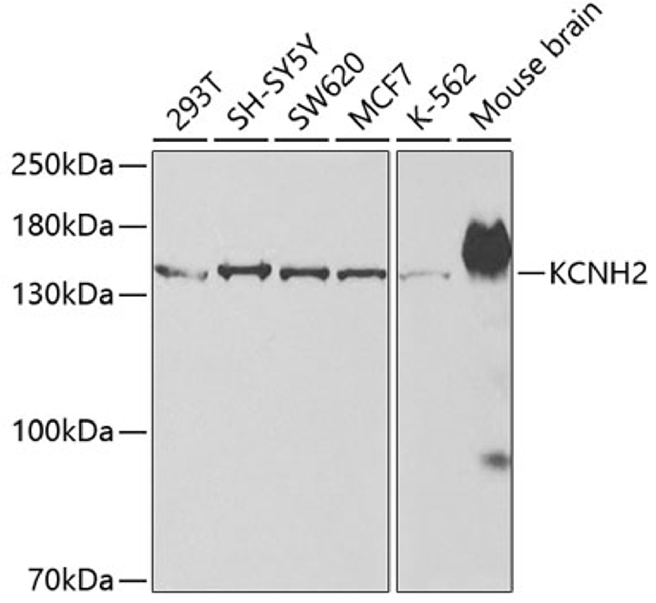 Western blot analysis of extracts of various cell lines, using KCNH2 antibody (18-888) at 1:500 dilution.<br/>Secondary antibody: HRP Goat Anti-Rabbit IgG (H+L) at 1:10000 dilution.<br/>Lysates/proteins: 25ug per lane.<br/>Blocking buffer: 3% nonfat dry milk in TBST.<br/>Detection: ECL Enhanced Kit.<br/>Exposure time: 30s.