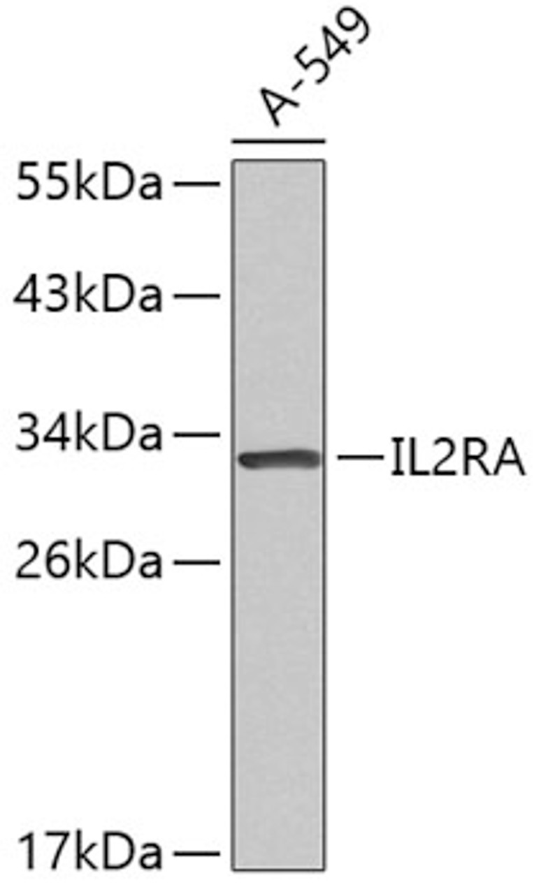 Western blot analysis of extracts of A-549 cells, using IL2RA antibody (18-894) .<br/>Secondary antibody: HRP Goat Anti-Rabbit IgG (H+L) at 1:10000 dilution.<br/>Lysates/proteins: 25ug per lane.<br/>Blocking buffer: 3% nonfat dry milk in TBST.