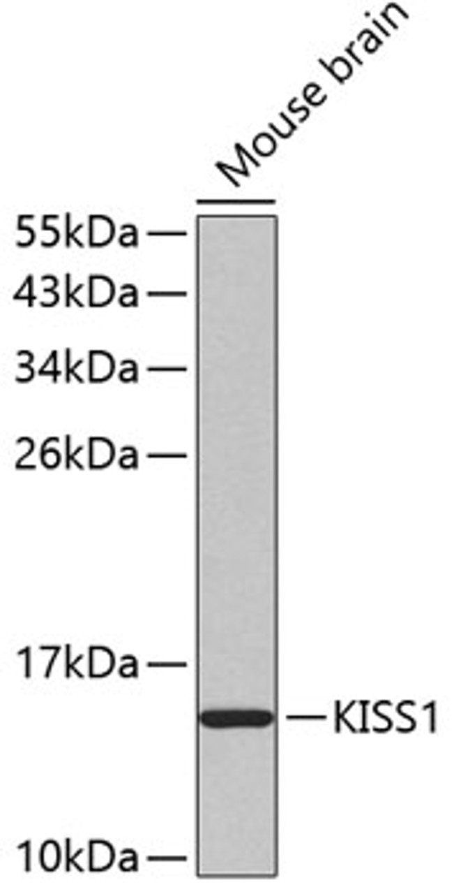 Western blot analysis of extracts of mouse brain, using KISS1 antibody (18-895) .<br/>Secondary antibody: HRP Goat Anti-Rabbit IgG (H+L) at 1:10000 dilution.<br/>Lysates/proteins: 25ug per lane.<br/>Blocking buffer: 3% nonfat dry milk in TBST.
