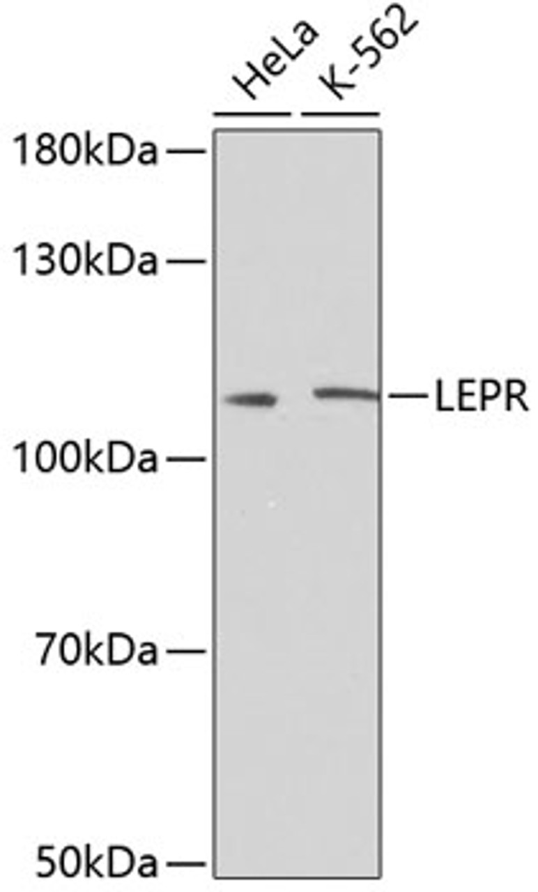 Western blot analysis of extracts of various cell lines, using LEPR antibody (18-901) at 1:500 dilution.<br/>Secondary antibody: HRP Goat Anti-Rabbit IgG (H+L) at 1:10000 dilution.<br/>Lysates/proteins: 25ug per lane.<br/>Blocking buffer: 3% nonfat dry milk in TBST.<br/>Detection: ECL Basic Kit.<br/>Exposure time: 90s.