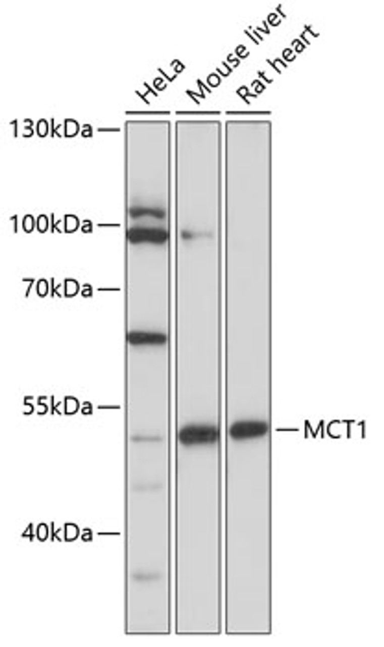 Western blot analysis of extracts of various cells, using MCT1 antibody (18-906) at 1:1000 dilution.<br/>Secondary antibody: HRP Goat Anti-Rabbit IgG (H+L) at 1:10000 dilution.<br/>Lysates/proteins: 25ug per lane.<br/>Blocking buffer: 3% nonfat dry milk in TBST.<br/>Detection: ECL Basic Kit.<br/>Exposure time: 5s.