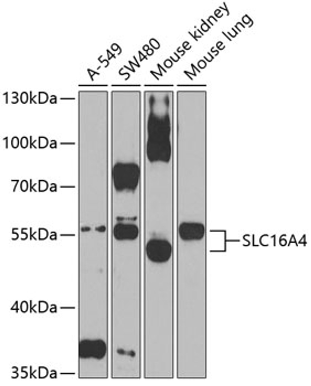 Western blot analysis of extracts of various cell lines, using SLC16A4 Antibody (18-907) at 1:1000 dilution.<br/>Secondary antibody: HRP Goat Anti-Rabbit IgG (H+L) at 1:10000 dilution.<br/>Lysates/proteins: 25ug per lane.<br/>Blocking buffer: 3% nonfat dry milk in TBST.<br/>Detection: ECL Basic Kit.<br/>Exposure time: 60s.