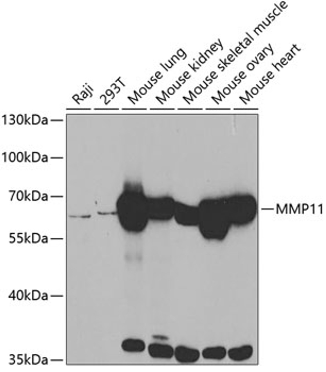 Western blot analysis of extracts of various cell lines, using MMP11 antibody (18-913) at 1:500 dilution.<br/>Secondary antibody: HRP Goat Anti-Rabbit IgG (H+L) at 1:10000 dilution.<br/>Lysates/proteins: 25ug per lane.<br/>Blocking buffer: 3% nonfat dry milk in TBST.<br/>Detection: ECL Basic Kit.<br/>Exposure time: 2min.
