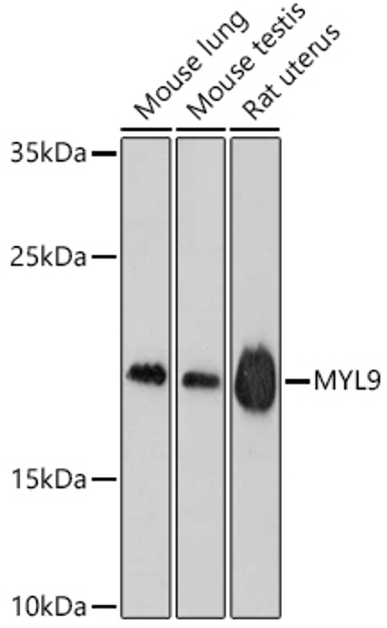 Western blot analysis of extracts of various cell lines, using MYL9 antibody (18-915) at 1:1000 dilution.<br/>Secondary antibody: HRP Goat Anti-Rabbit IgG (H+L) at 1:10000 dilution.<br/>Lysates/proteins: 25ug per lane.<br/>Blocking buffer: 3% nonfat dry milk in TBST.<br/>Detection: ECL Basic Kit.<br/>Exposure time: 90s.