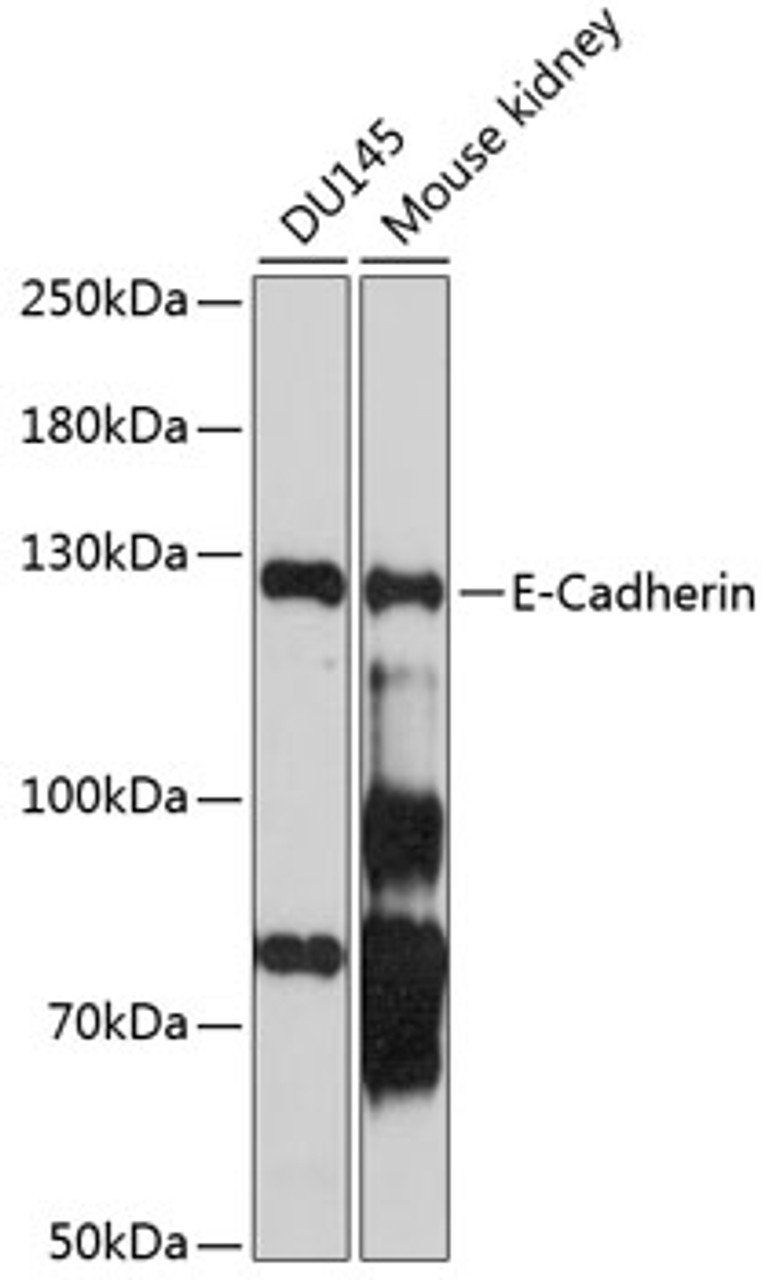 Western blot analysis of extracts of various cell lines, using E-Cadherin antibody (18-916) at 1:1000 dilution.<br/>Secondary antibody: HRP Goat Anti-Rabbit IgG (H+L) at 1:10000 dilution.<br/>Lysates/proteins: 25ug per lane.<br/>Blocking buffer: 3% nonfat dry milk in TBST.<br/>Detection: ECL Basic Kit.<br/>Exposure time: 90s.