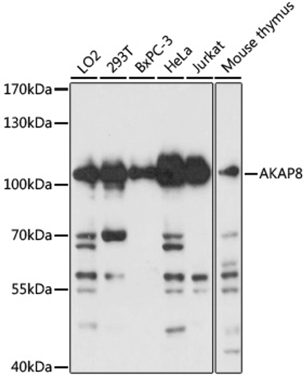 Western blot analysis of extracts of various cell lines, using AKAP8 antibody (18-919) at 1:3000 dilution.<br/>Secondary antibody: HRP Goat Anti-Rabbit IgG (H+L) at 1:10000 dilution.<br/>Lysates/proteins: 25ug per lane.<br/>Blocking buffer: 3% nonfat dry milk in TBST.<br/>Detection: ECL Basic Kit.<br/>Exposure time: 30s.