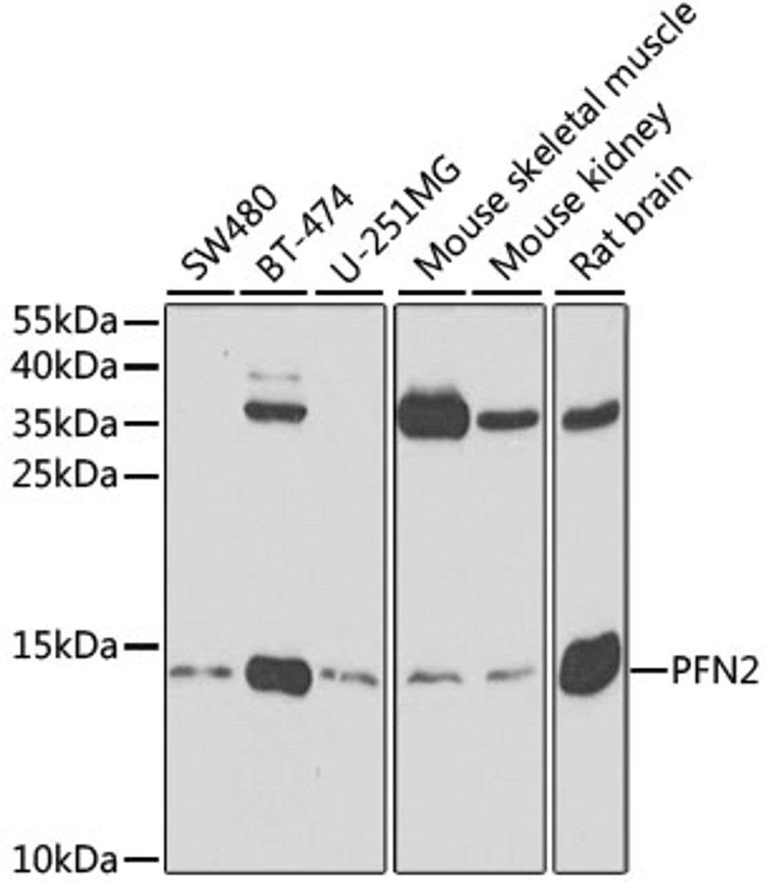 Western blot analysis of extracts of various cell lines, using PFN2 antibody (18-927) at 1:500 dilution.<br/>Secondary antibody: HRP Goat Anti-Rabbit IgG (H+L) at 1:10000 dilution.<br/>Lysates/proteins: 25ug per lane.<br/>Blocking buffer: 3% nonfat dry milk in TBST.<br/>Detection: ECL Enhanced Kit.<br/>Exposure time: 90s.