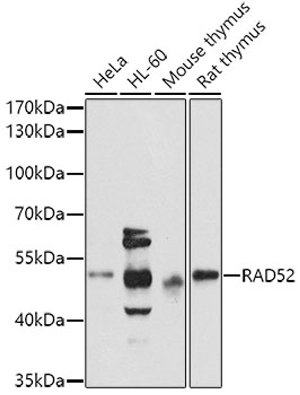 Western blot analysis of extracts of various cell lines, using RAD52 antibody (18-930) at 1:1000 dilution.<br/>Secondary antibody: HRP Goat Anti-Rabbit IgG (H+L) at 1:10000 dilution.<br/>Lysates/proteins: 25ug per lane.<br/>Blocking buffer: 3% nonfat dry milk in TBST.<br/>Detection: ECL Basic Kit.<br/>Exposure time: 90s.