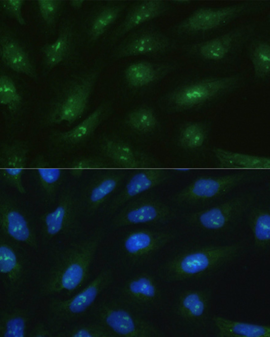 Immunofluorescence analysis of U2OS cells using RAD50 antibody (18-931) at dilution of 1:100. Blue: DAPI for nuclear staining.