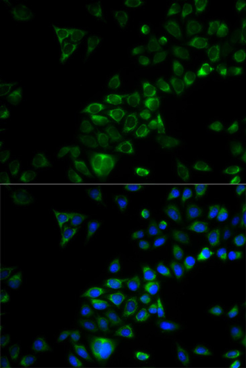 Immunofluorescence analysis of HeLa cells using TRAF3 antibody (18-938) . Blue: DAPI for nuclear staining.